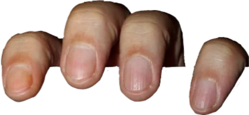 Стикер поймали